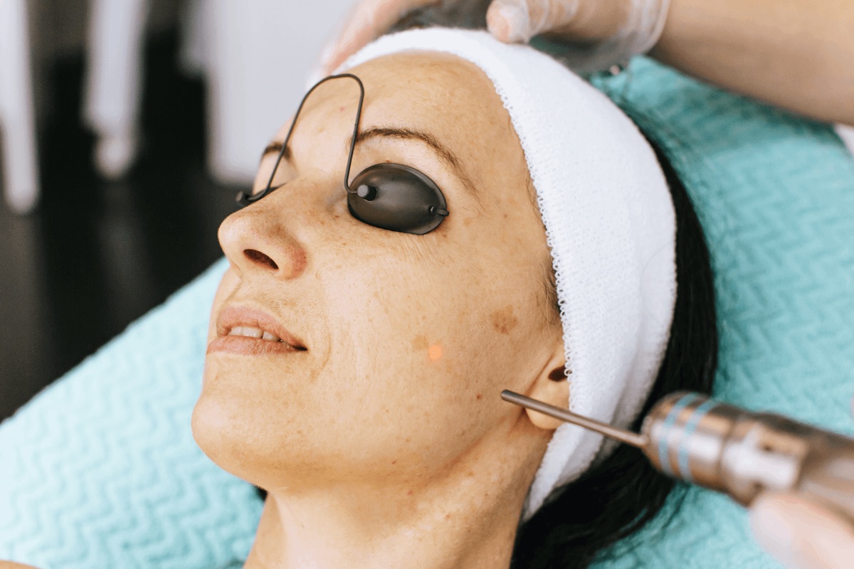 Sesión de Fotona4Glow con protección ocular en Impuls ProAge, Barcelona